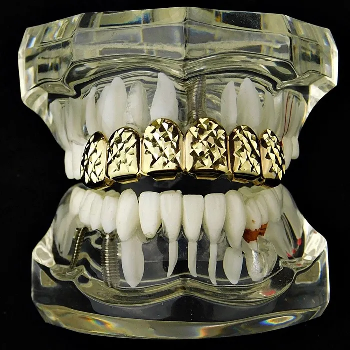 Earrings 14K Gold Plated DiamondCut Top Teeth Grillz Bling Cartel Admin