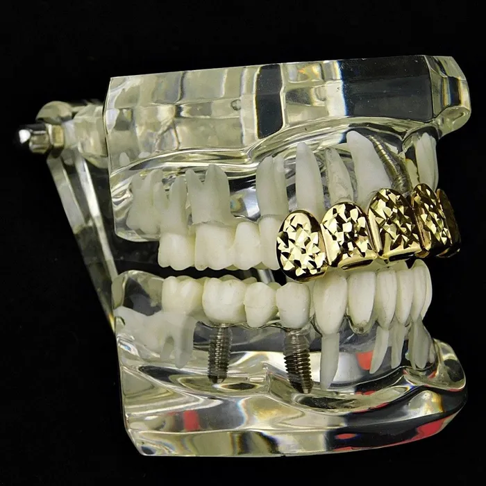 Earrings 14K Gold Plated DiamondCut Top Teeth Grillz Bling Cartel Admin